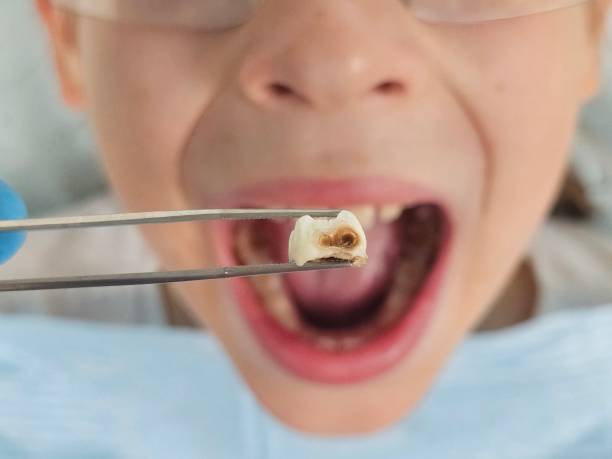 Best Tooth Infection Emergency Dentist  in Moncks Corner, SC